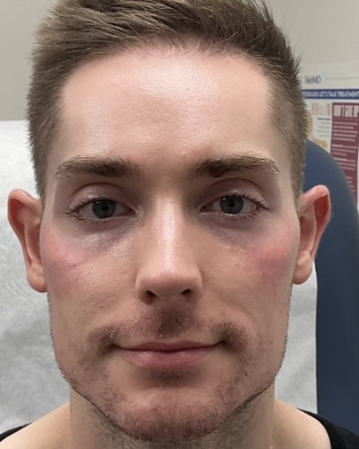 Before and After Picture