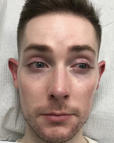 Before and After Picture