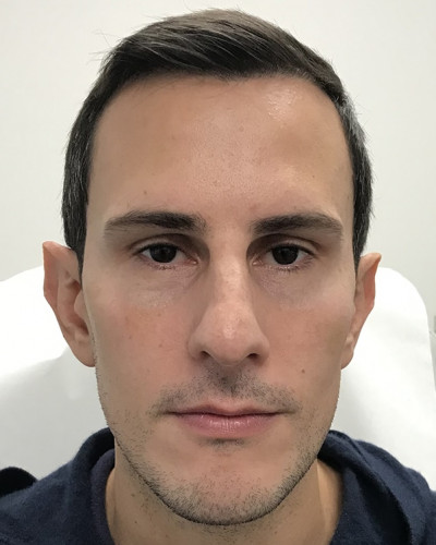 Before and After Picture