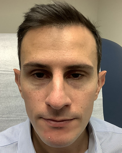 Before and After Picture