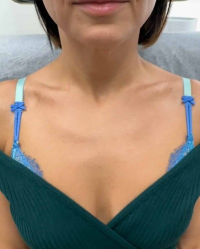 Before and After Picture