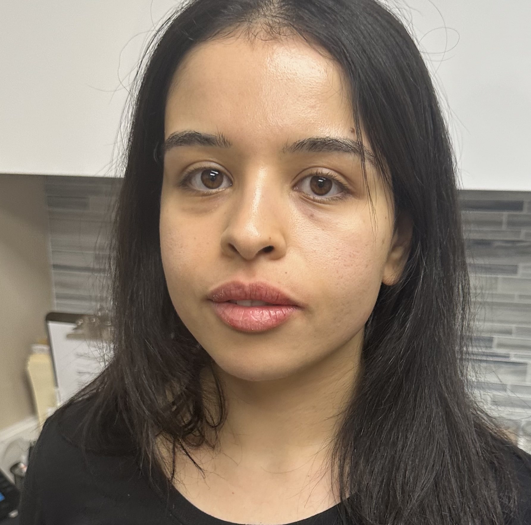 Before and After Picture