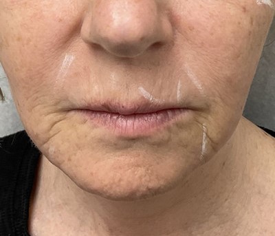 Before and After Picture