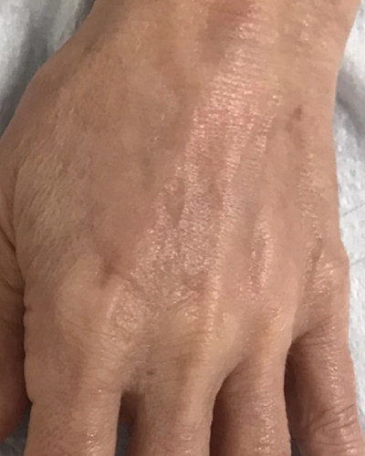 Before and After Picture