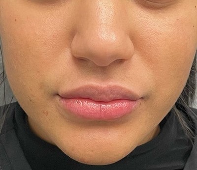 Before and After Picture