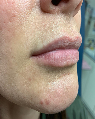 Before and After Picture