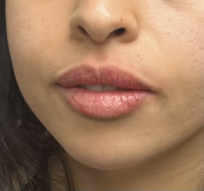 Before and After Picture