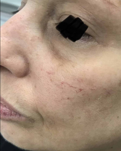 Before and After Picture