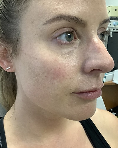 Before and After Picture