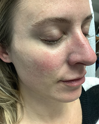 Before and After Picture