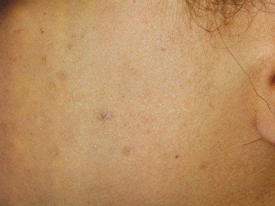 Before and After Picture