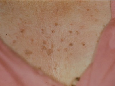 Before and After Picture