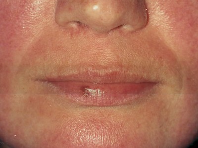 Before and After Picture