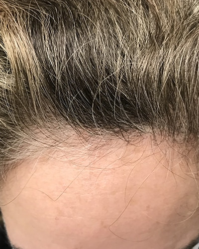 Before and After Picture