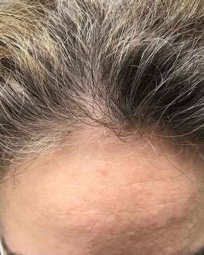 Before and After Picture