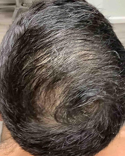 Before and After Picture