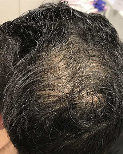 Before and After Picture