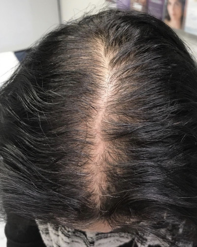 Before and After Picture