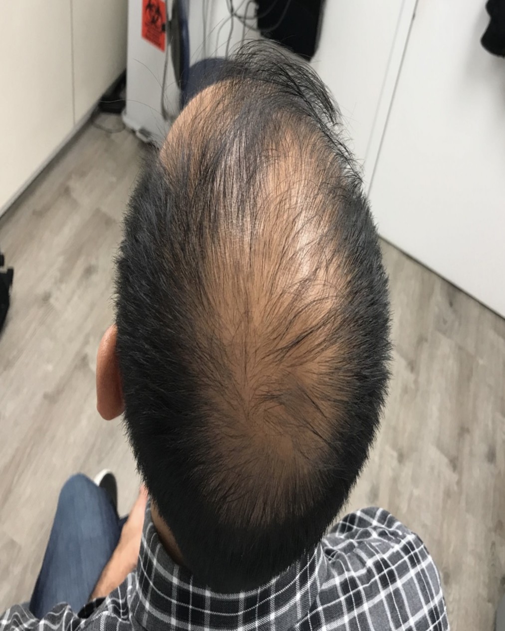 Before and After Picture