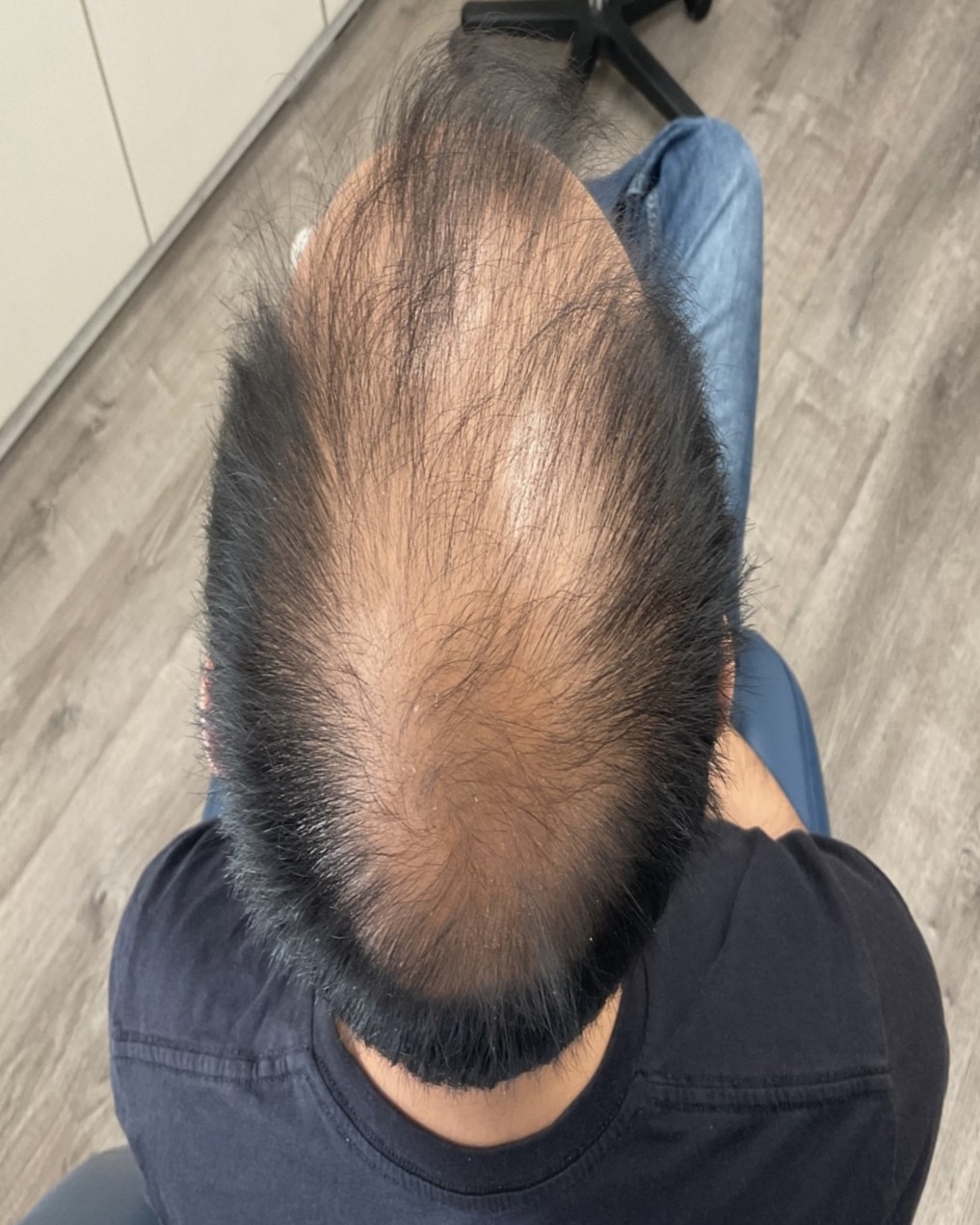 Before and After Picture