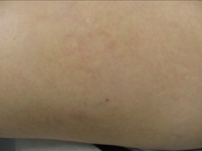 Before and After Picture