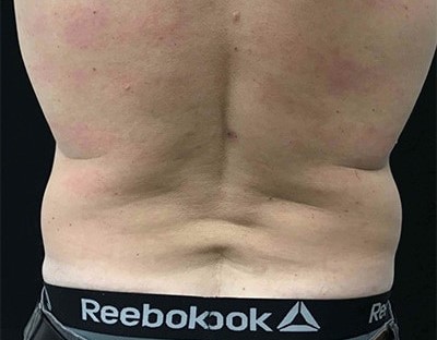 Before and After Picture