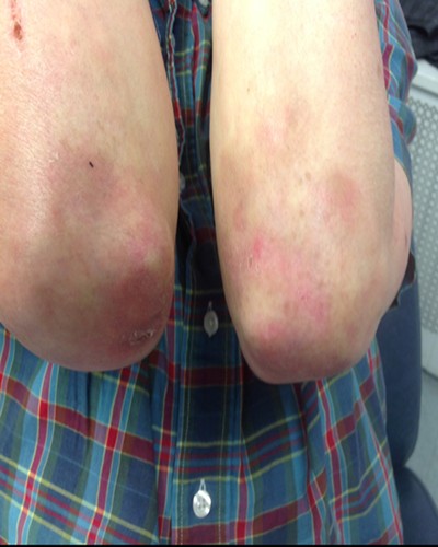 Before and After Picture