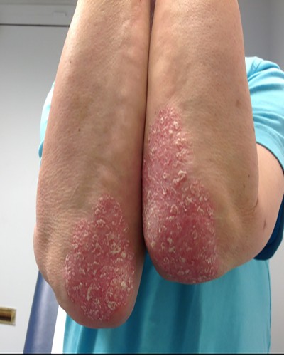 Before and After Picture