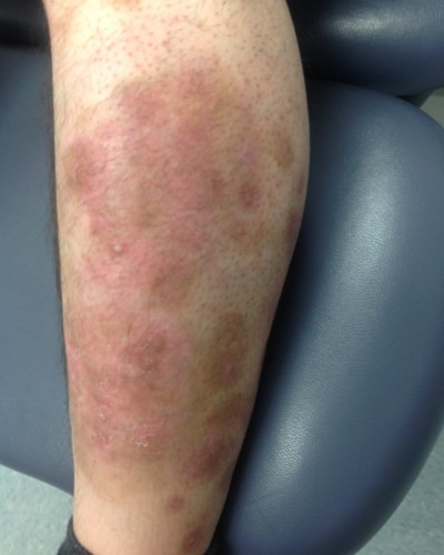 Before and After Picture