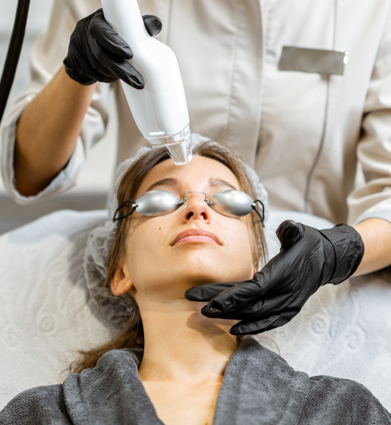 Laser Hair Removal Procedure in Face